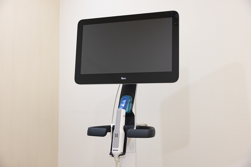 iTero（アイテロ）って何？