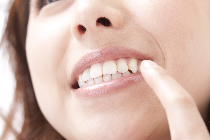 ホワイトニングとは何か？